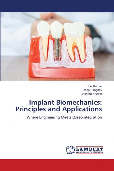 Implant Biomechanics