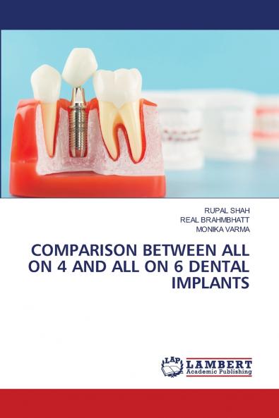 COMPARISON BETWEEN ALL ON 4 AND ALL ON 6 DENTAL IMPLANTS