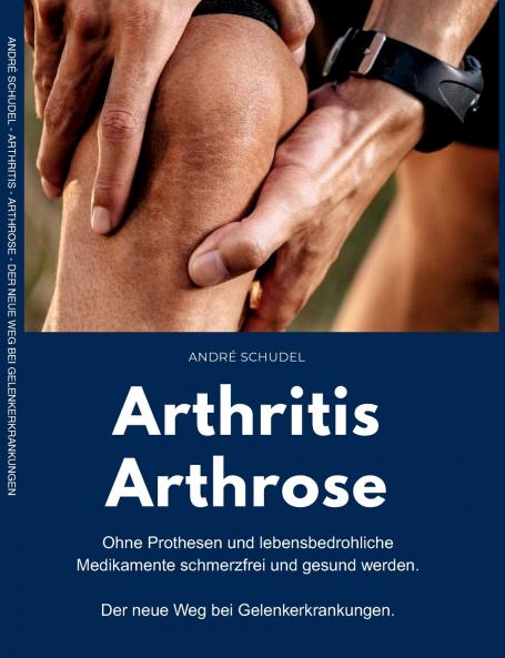 Arthritis - Arthrose. Ohne Prothesen und lebensbedrohliche Medikamente schmerzfrei und gesund werden. Der neue Weg bei Gelenkerkrankungen