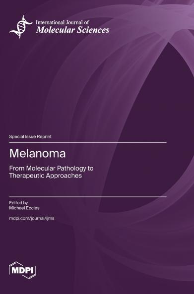 Melanoma