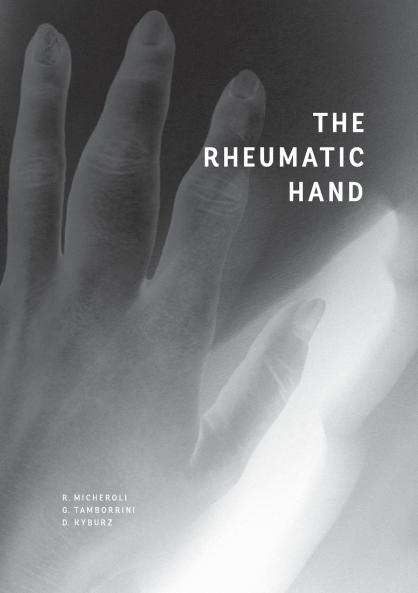 The Rheumatic Hand