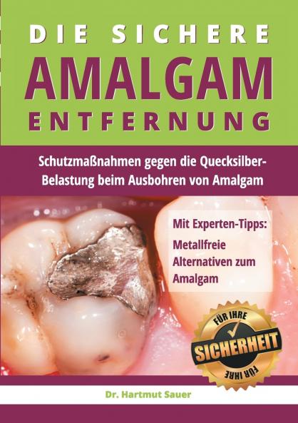 Die sichere Amalgam-Entfernung