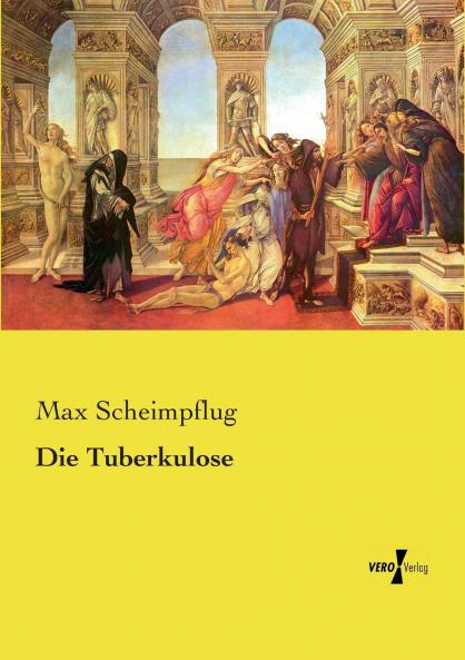 Die Tuberkulose