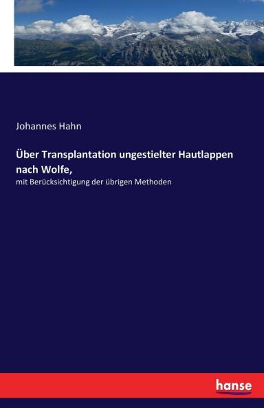 Über Transplantation ungestielter Hautlappen nach Wolfe