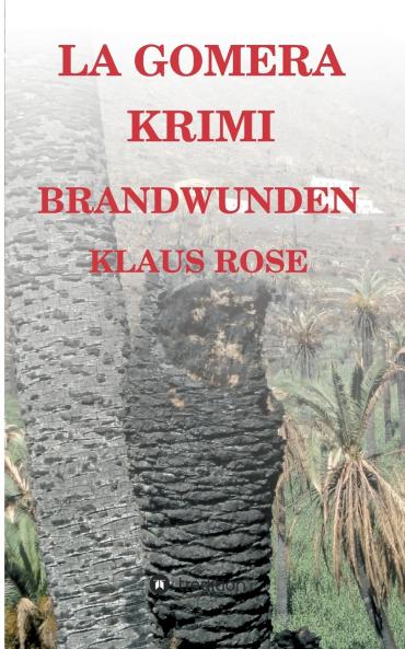 Brandwunden