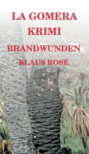 Brandwunden