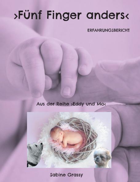 Fünf Finger anders