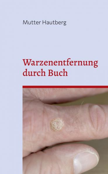 Warzenentfernung durch Buch