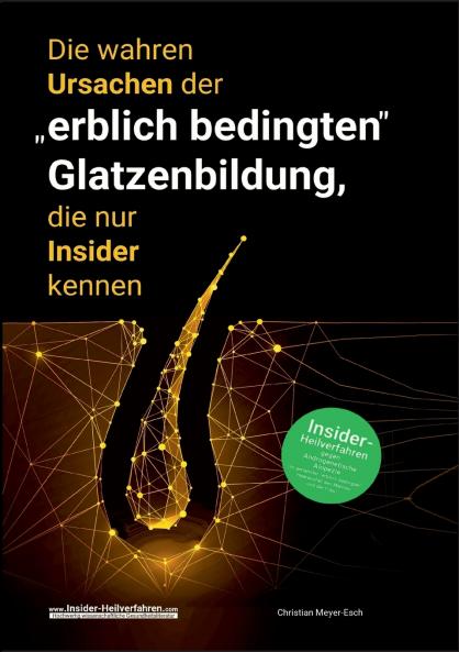 Die wahren Ursachen der erblich bedingten Glatzenbildung die nur Insider kennen