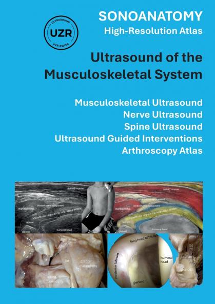 Sonoanatomy - High-Resolution Atlas - Ultrasound of the Musculoskeletal System