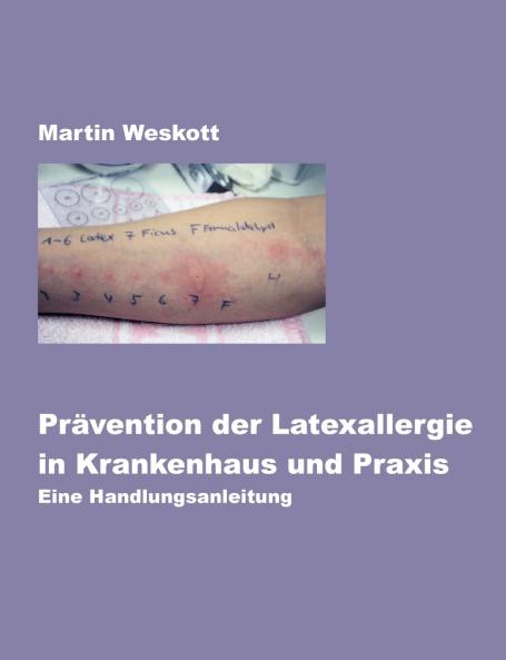 Prävention der Latexallergie in Krankenhaus und Praxis