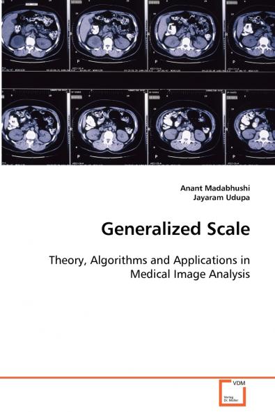 Generalized Scale
