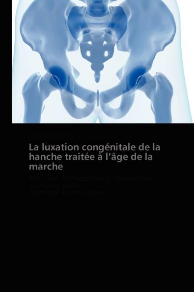 La luxation congénitale de la hanche traitée à  l âge de la marche