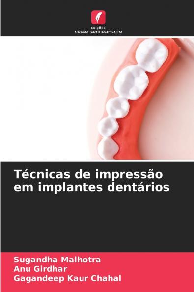 Técnicas de impressão em implantes dentários