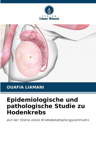 Epidemiologische und pathologische Studie zu Hodenkrebs