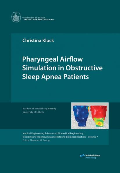 Pharyngeal Airflow Simulation in Obstructive Sleep Apnea Patients