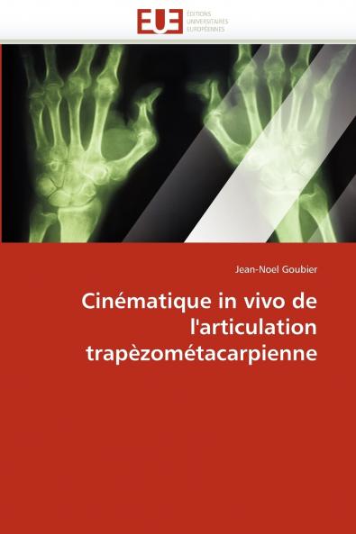 Cinématique in vivo de l''articulation trapèzométacarpienne