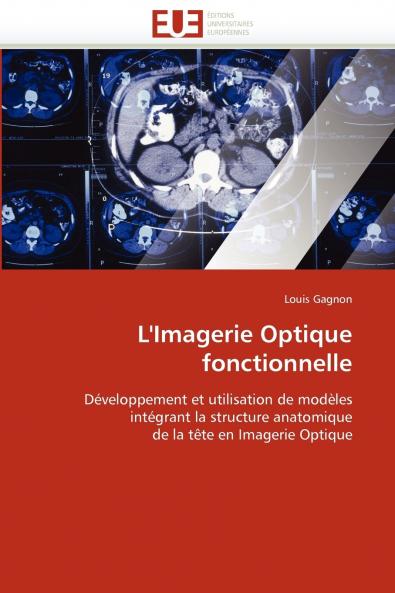 L'imagerie optique fonctionnelle