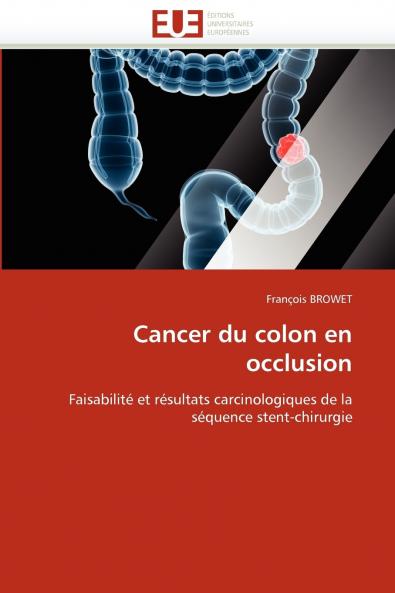 Cancer du colon en occlusion