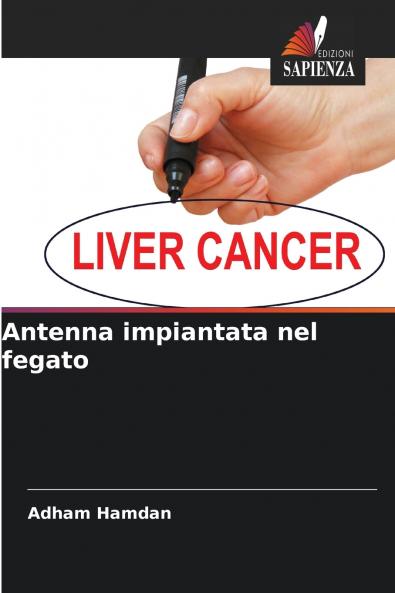 Antenna impiantata nel fegato