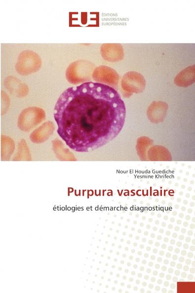 Purpura vasculaire