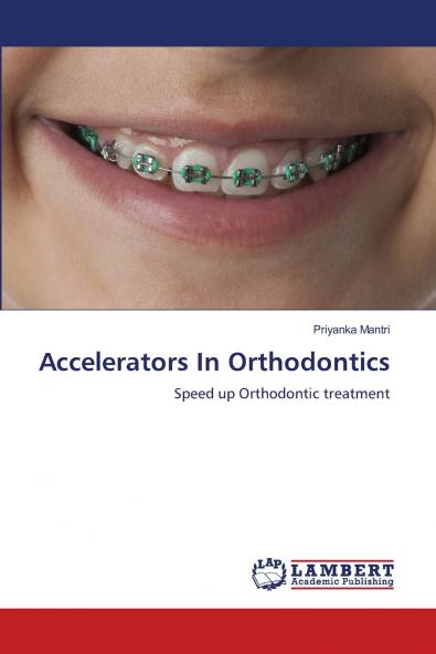 Accelerators In Orthodontics