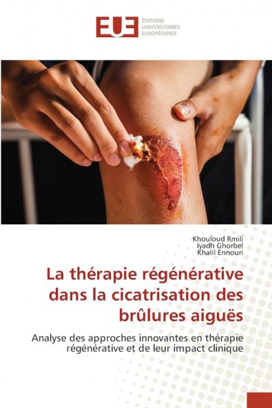 La thérapie régénérative dans la cicatrisation des brûlures aiguës