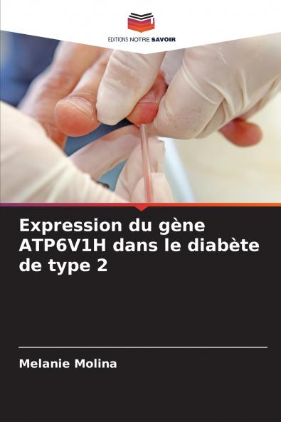 Expression du gène ATP6V1H dans le diabète de type 2