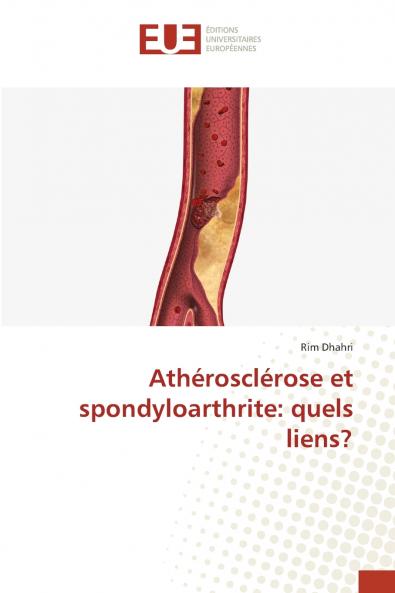 Athérosclérose et spondyloarthrite