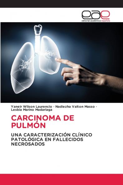 CARCINOMA DE PULMÓN