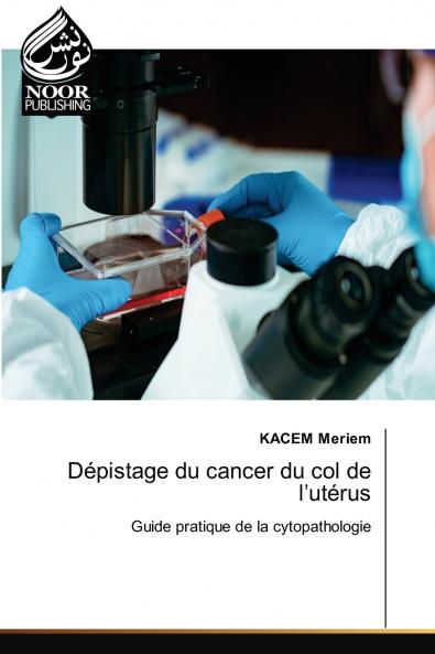 Dépistage du cancer du col de l'utérus