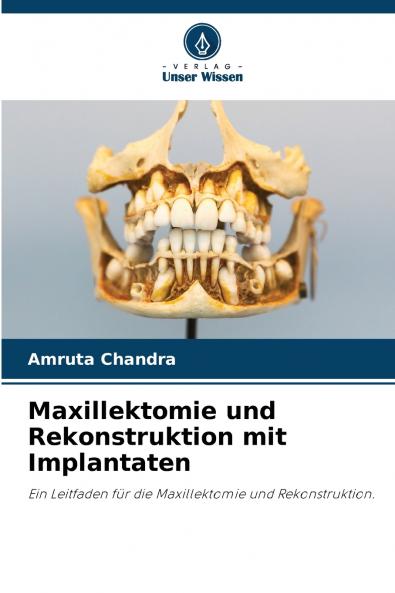 Maxillektomie und Rekonstruktion mit Implantaten