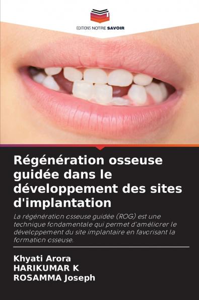 Régénération osseuse guidée dans le développement des sites d'implantation