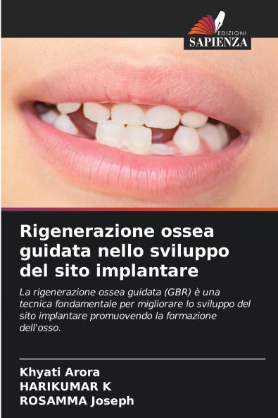 Rigenerazione ossea guidata nello sviluppo del sito implantare