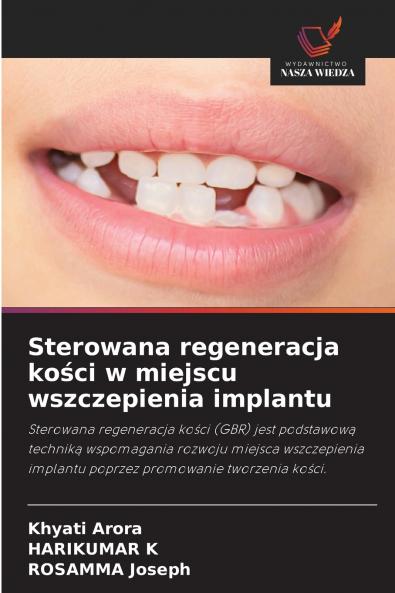 Sterowana regeneracja kości w miejscu wszczepienia implantu