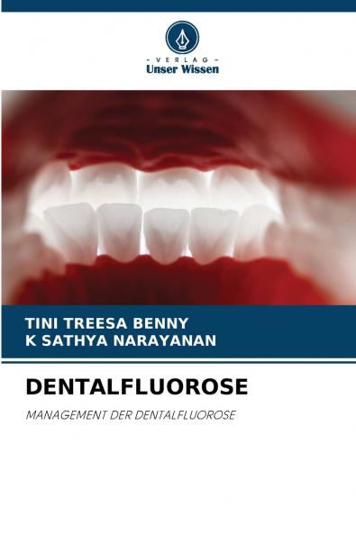 DENTALFLUOROSE