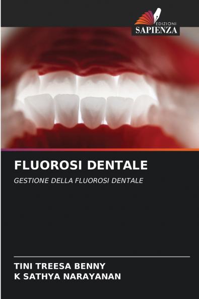 FLUOROSI DENTALE