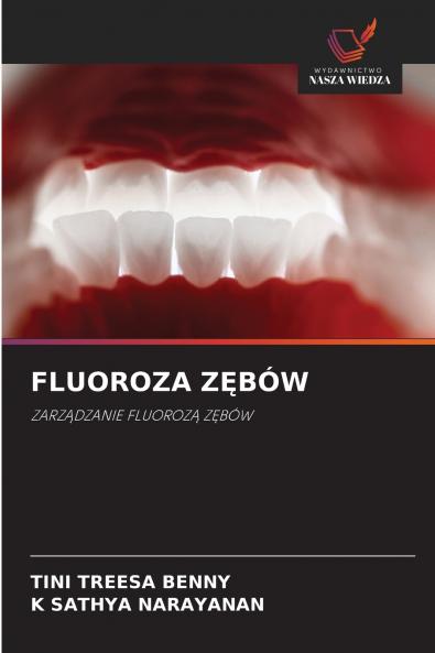FLUOROZA ZĘBÓW
