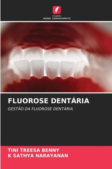 FLUOROSE DENTÁRIA
