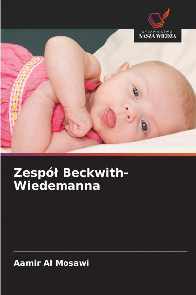 Zespół Beckwith-Wiedemanna