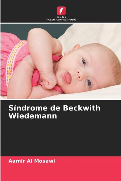 Síndrome de Beckwith Wiedemann