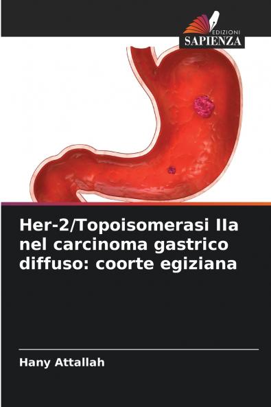 Her-2/Topoisomerasi IIa nel carcinoma gastrico diffuso