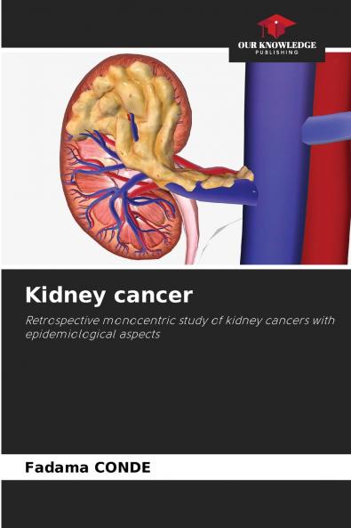 Kidney cancer