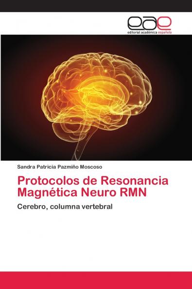 Protocolos de Resonancia Magnética Neuro RMN