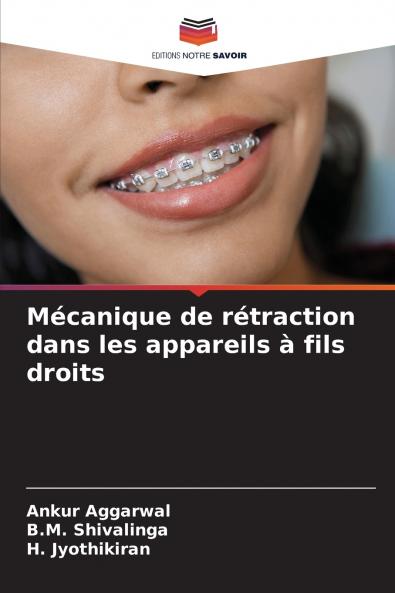 Mécanique de rétraction dans les appareils à fils droits