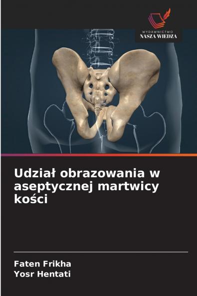 Udział obrazowania w aseptycznej martwicy kości