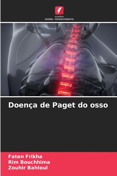 Doença de Paget do osso