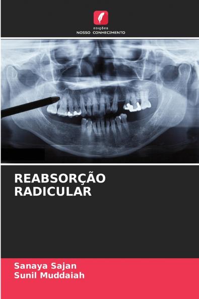 REABSORÇÃO RADICULAR