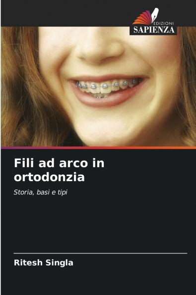 Fili ad arco in ortodonzia