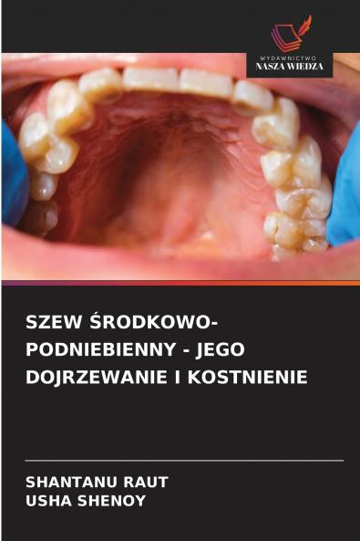 SZEW ŚRODKOWO-PODNIEBIENNY - JEGO DOJRZEWANIE I KOSTNIENIE